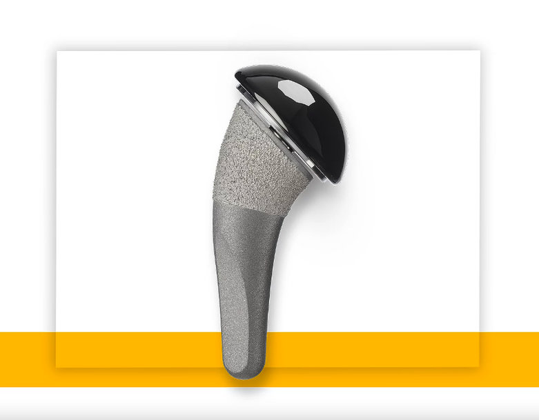 STRYKER COMPLETES FIRST CLINICAL USE OF TORNIER PYROCARBON HUMERAL HEAD